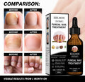 Fungal Nail Treatment Oil