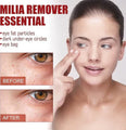 Smooth Milia Remover Serum (30ml)